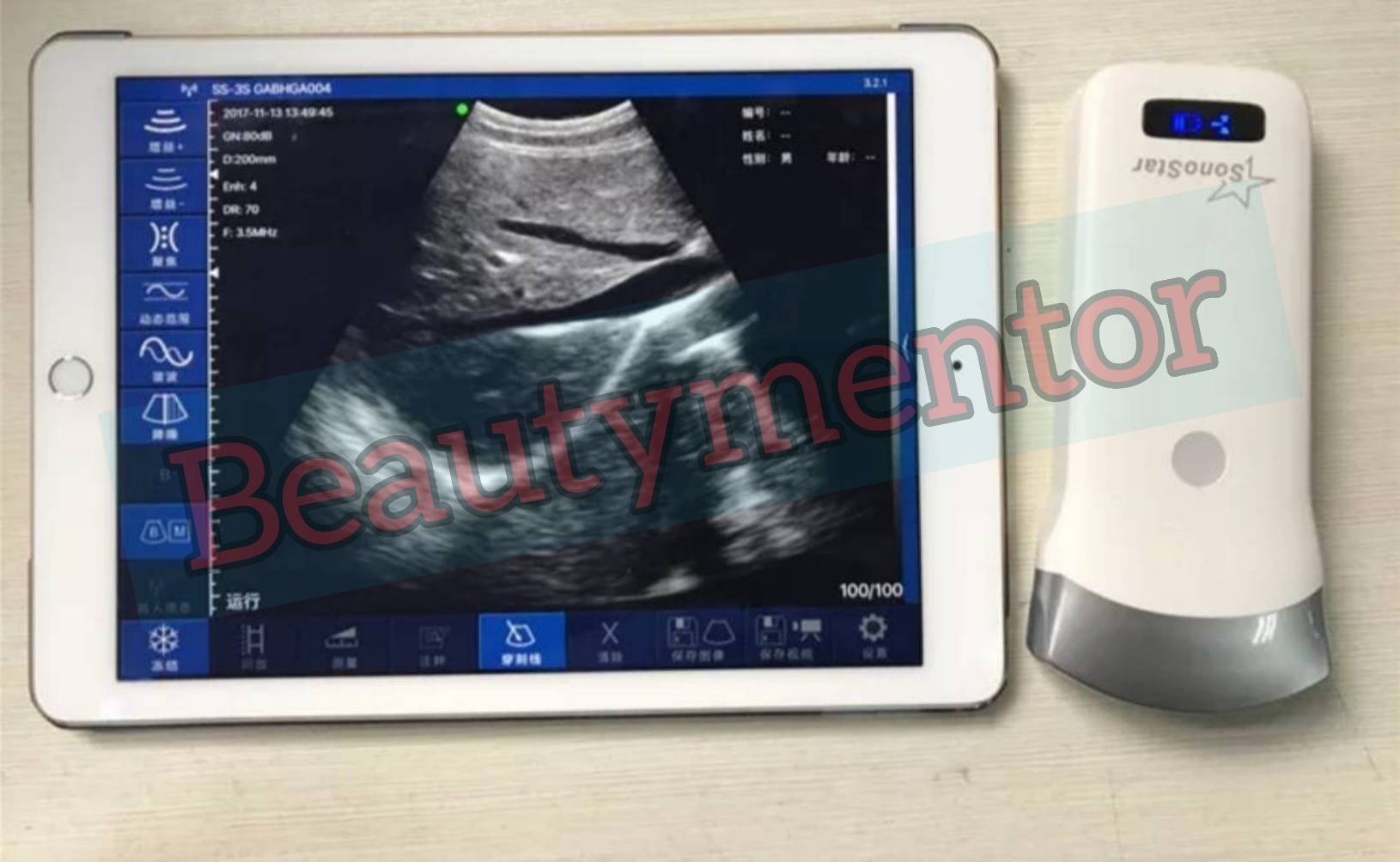 Ultrasound Mini