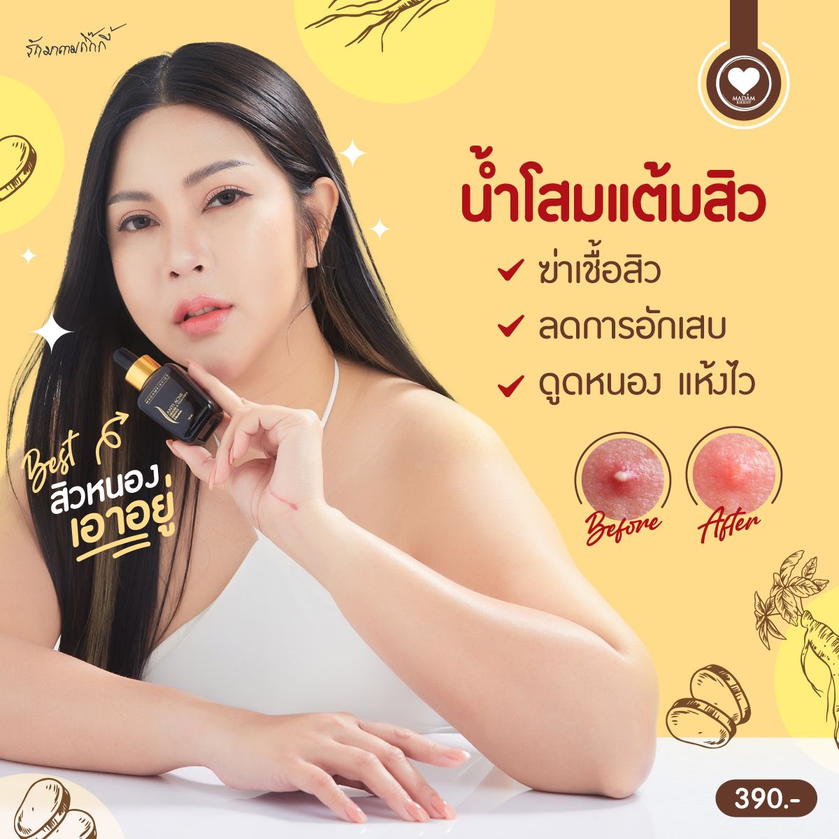 น้ำโสมแต้มสิว