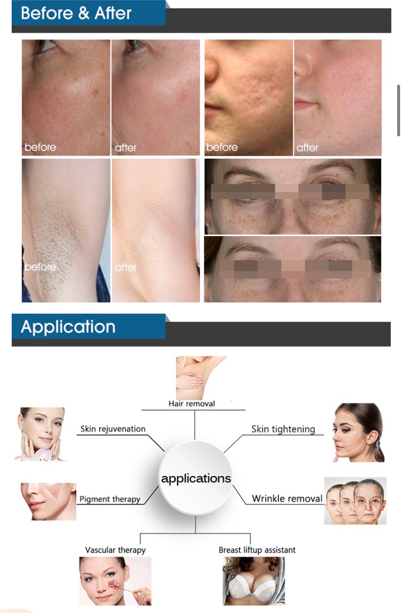 Super Diode 808nm อยไทย