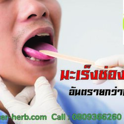 ภัยเงียบ "มะเร็งช่องปาก"